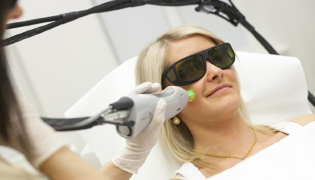 Rajeunissement au laser
