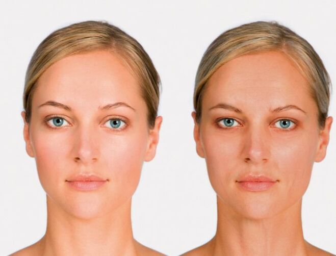 Face plus tard et avant le rajeunissement