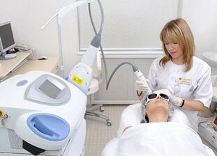 Avantages et inconvénients du resurfaçage partiel de la peau du visage au laser